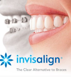 invisalign image